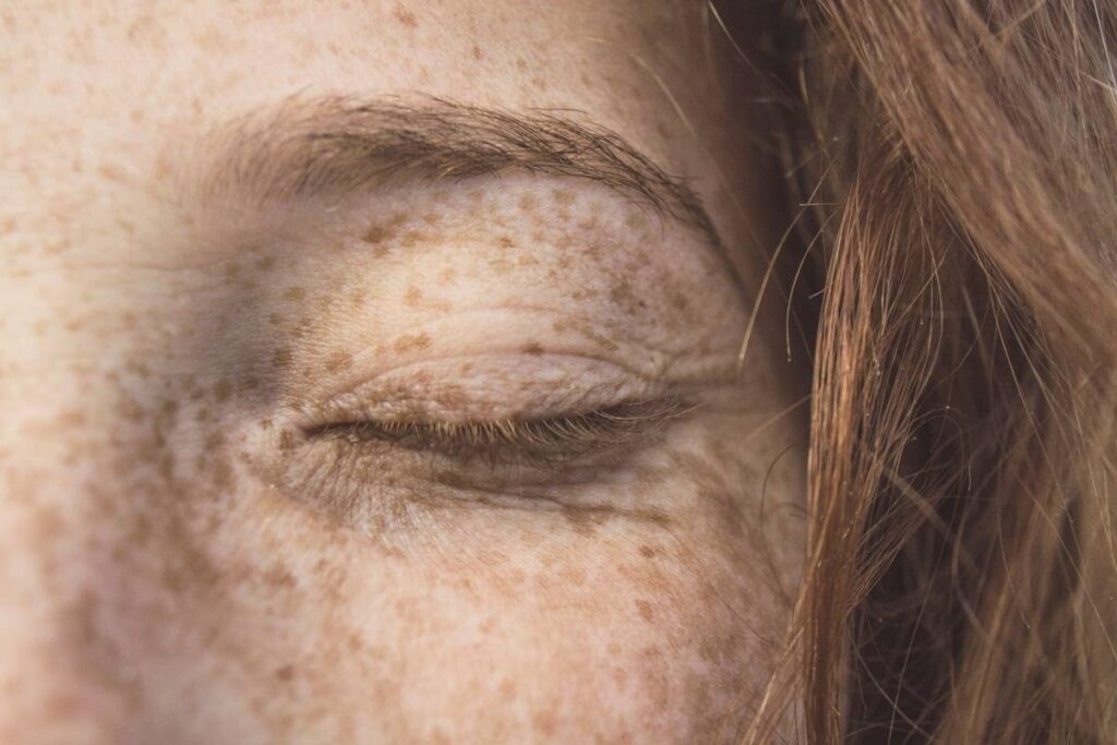 Kobieta z piegami na twarzy