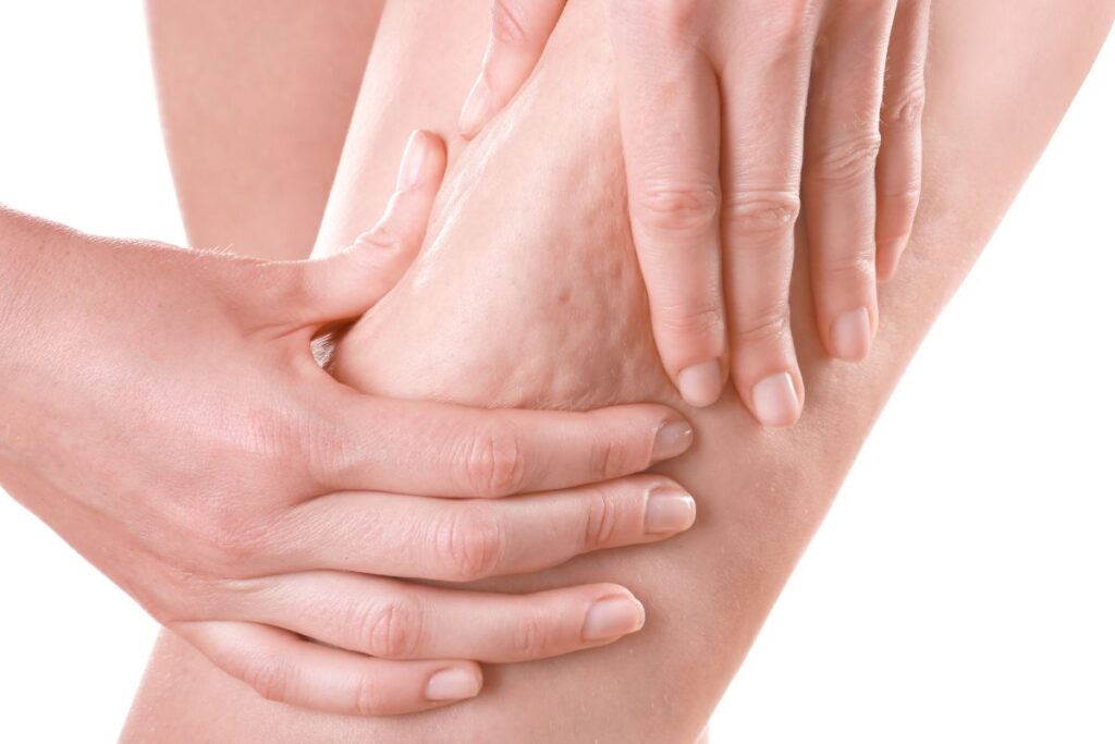 Kobieta uciska udo, co uwidacznia tkankę tłuszczową pod skórą