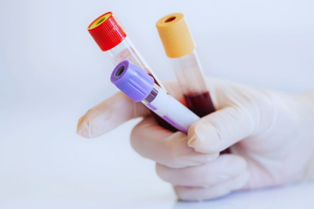 próbki krwi do laboratorium